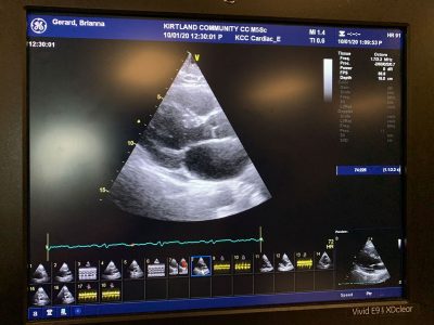Cardiac Sonography scan